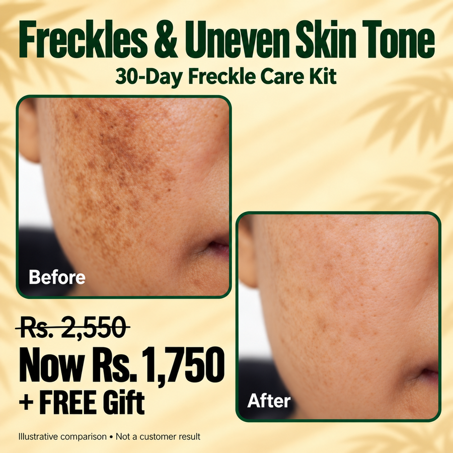 30-Day Freckle Care Kit | Freckle Cream & Rice Collagen Skincare