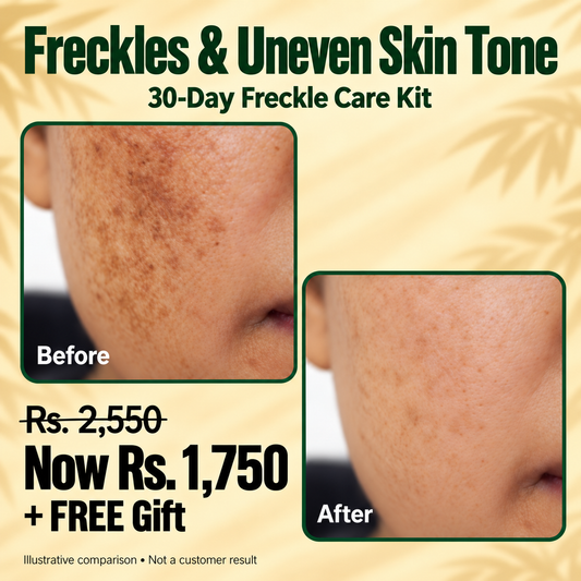30-Day Freckle Care Kit | Freckle Cream & Rice Collagen Skincare