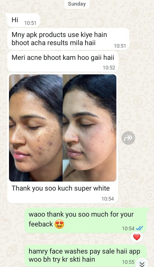 30-Day Freckle Care Kit | Freckle Cream & Rice Collagen Skincare