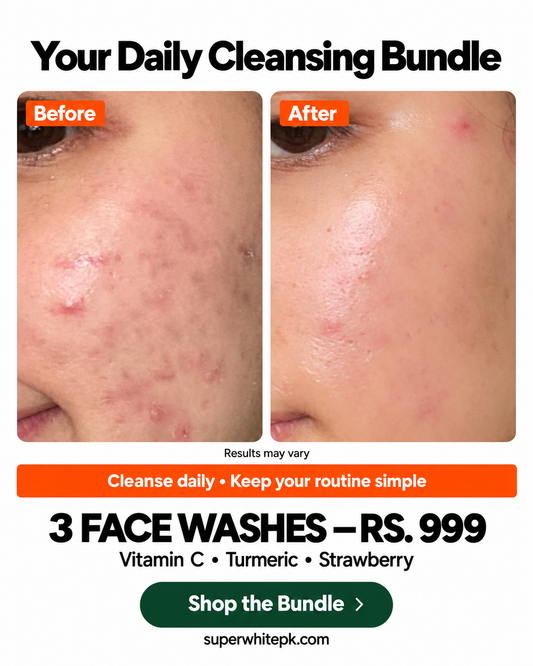 Super White Face 3 Washes – Just Rs. 999