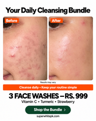 Super White Face 3 Washes – Just Rs. 999